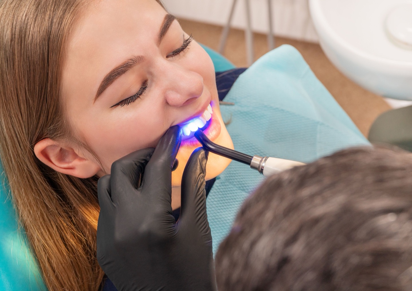 A curing light setting composite bonding on a patient’s front teeth
